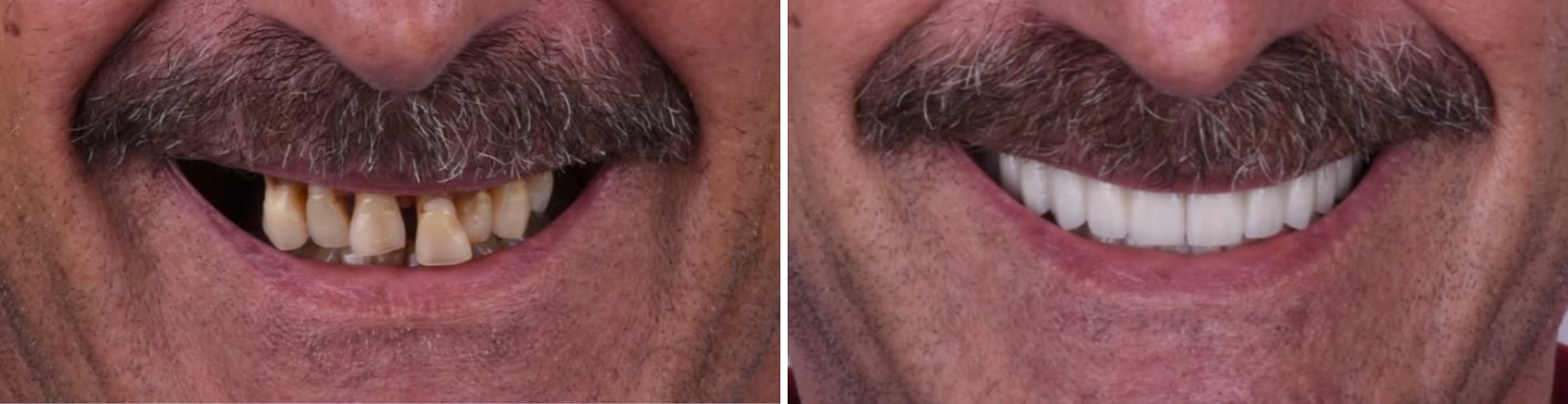 Before and After Dental Treatment