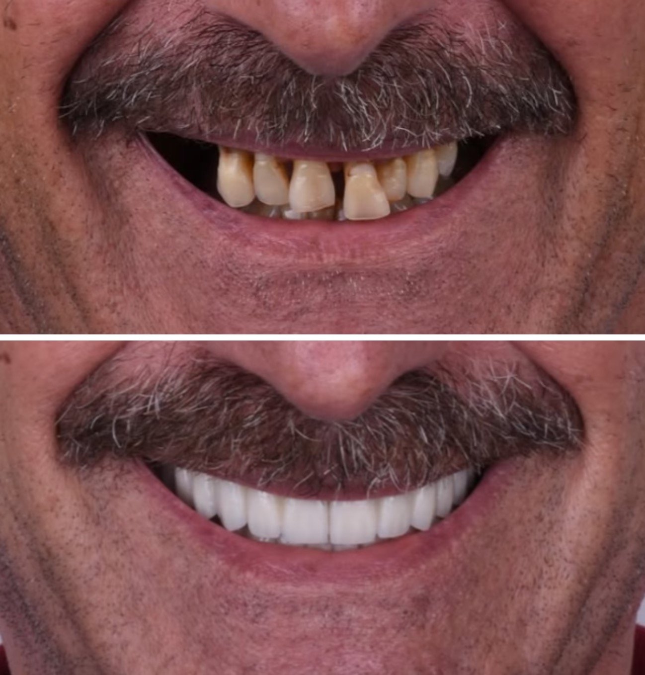 Before and After Dental Treatment